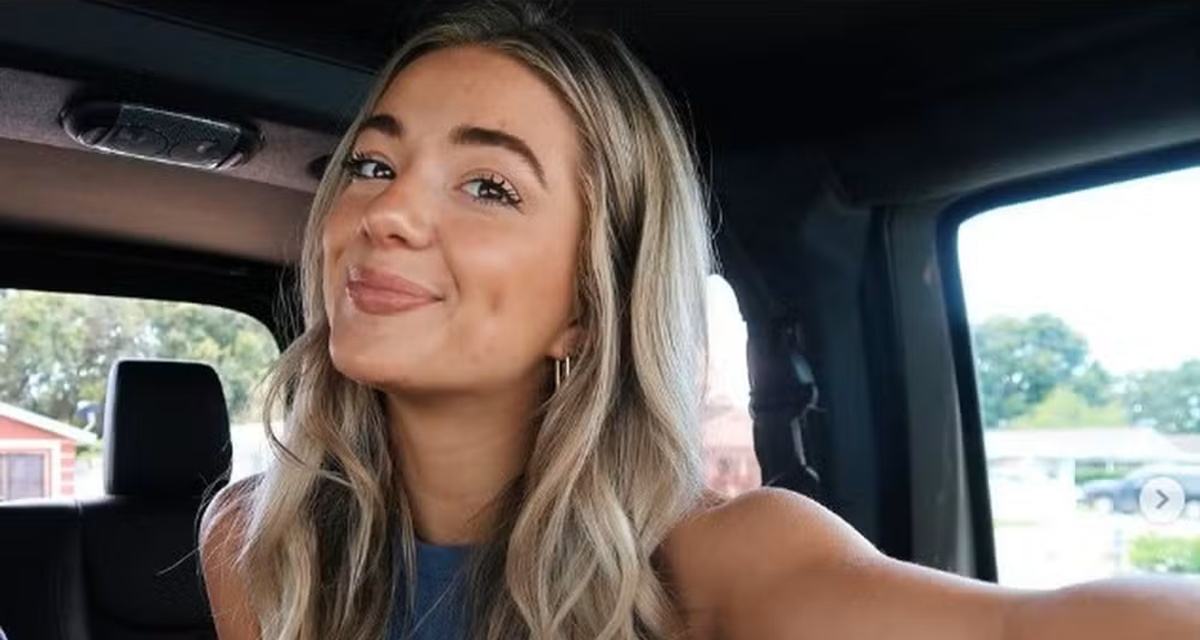 V Tima De Ataque De Tubar O Faz Sucesso Como Modelo Cicatriz Fascina